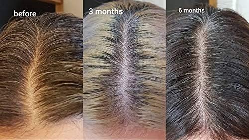 The Ordinary Multi-Peptide Serum For Hair Density 60ml