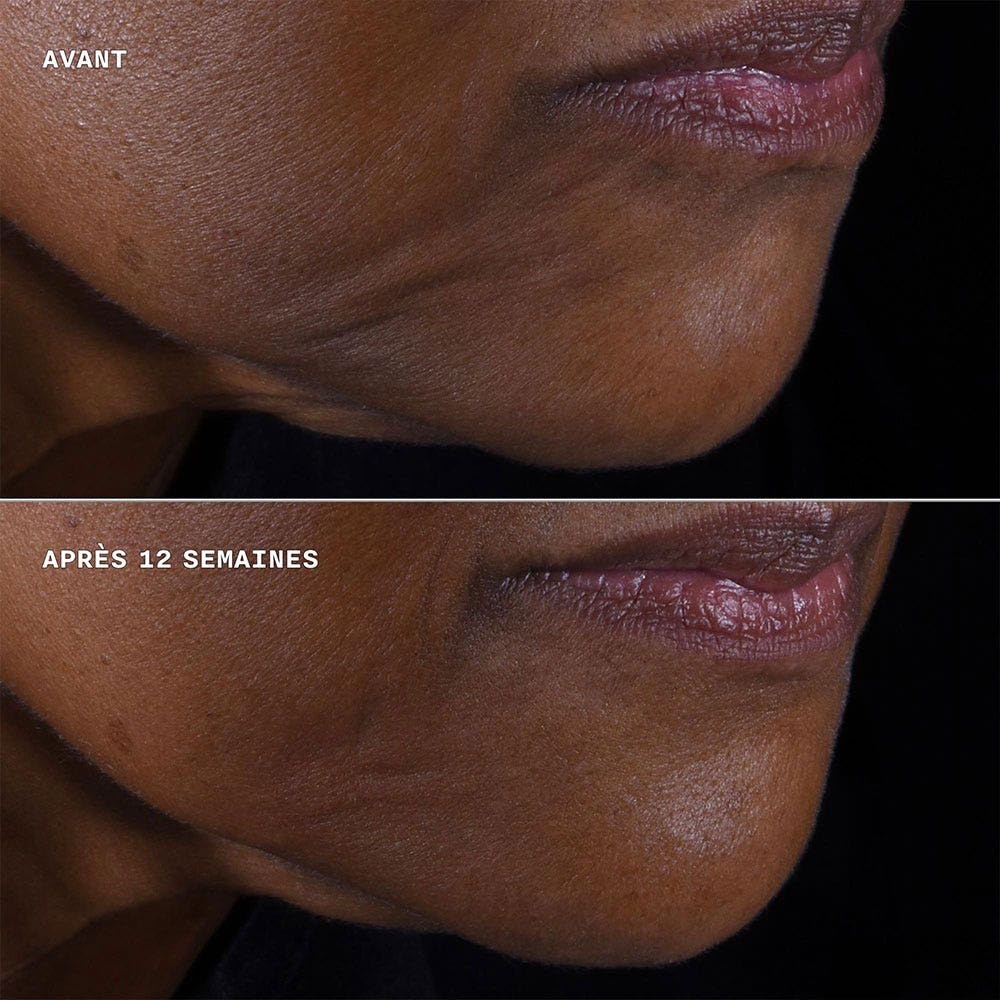 Clinique Smart Clinical Repair Lifting Face + Neck Cream 50ml