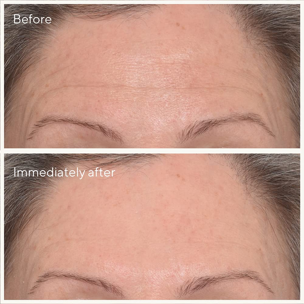 Murad The Derm Report Minimizing Lines + Wrinkles