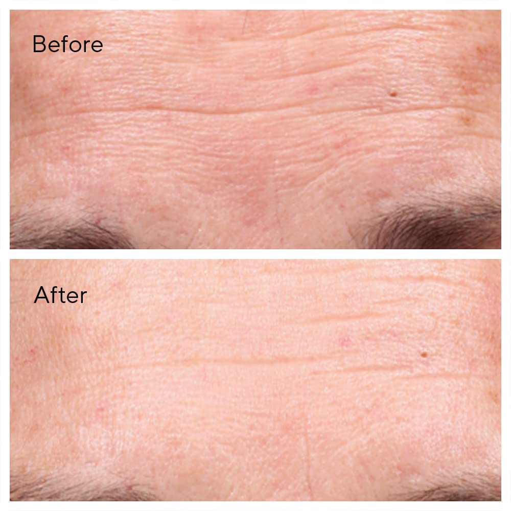 Murad The Derm Report Minimizing Lines + Wrinkles