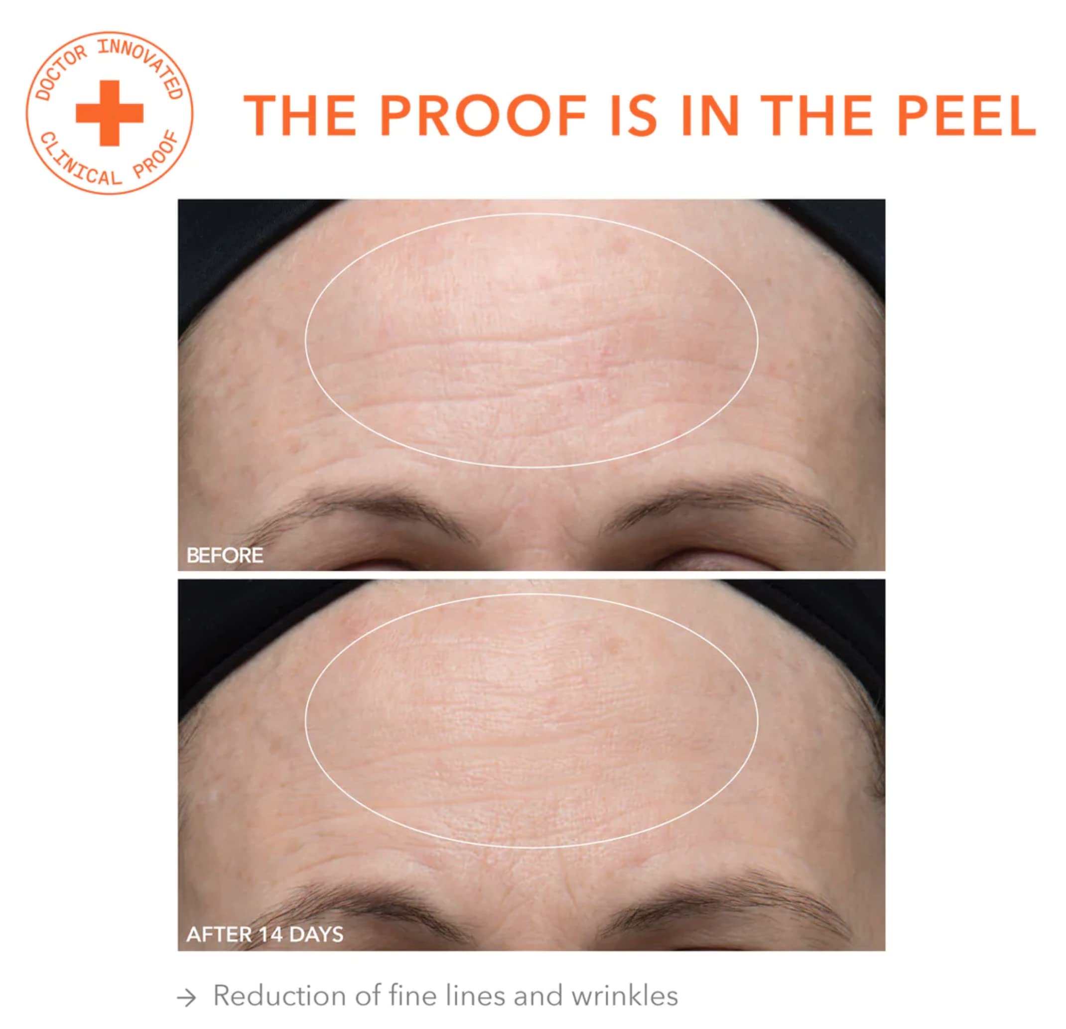 Dr Dennis Gross Alpha Beta Ultra Gentle Daily Peel 2.2ml x 30