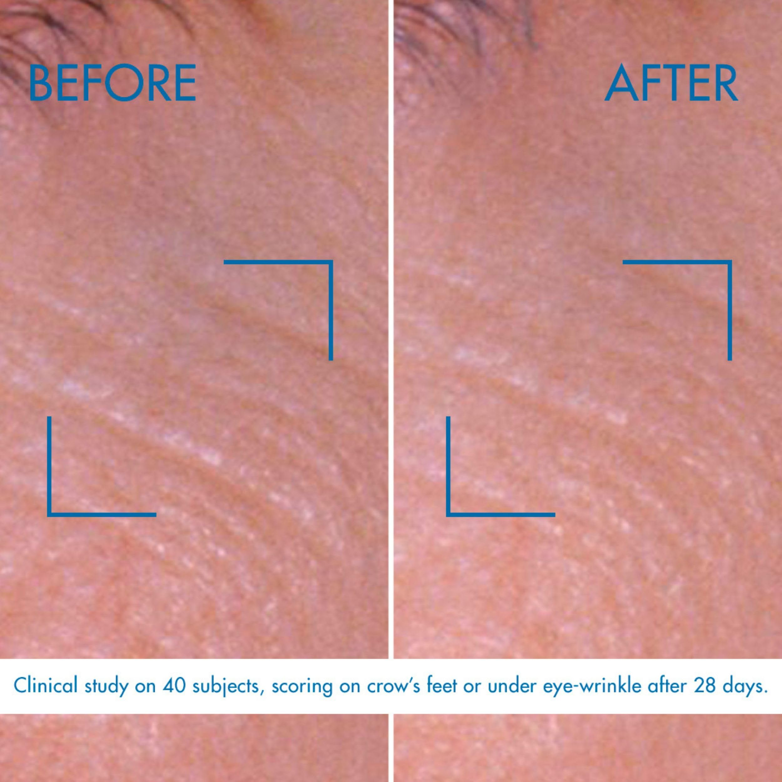 Biotherm Blue Pro-Retinol Eye Cream 15ml