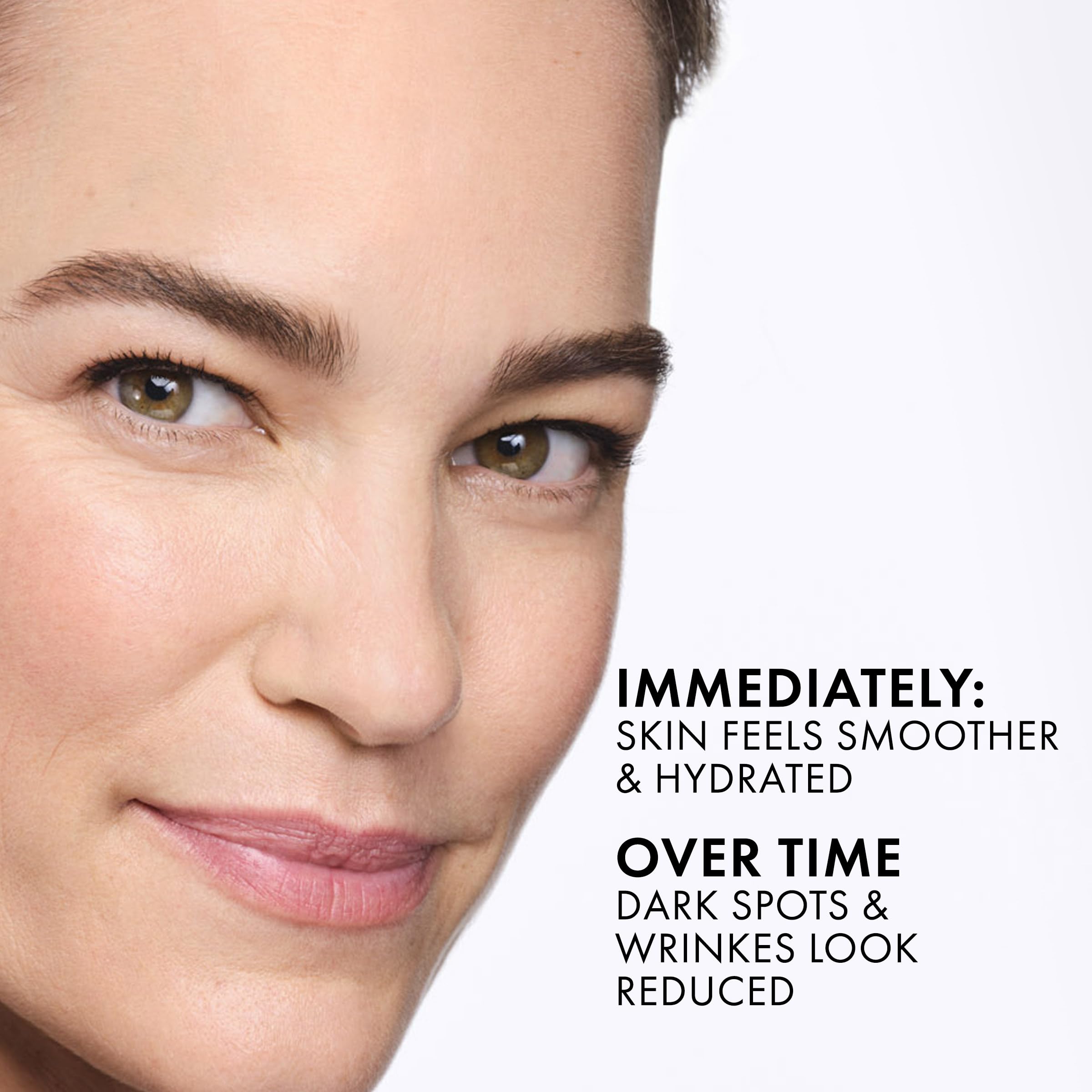 Vichy Dercos Anti-Dandruff Shampoo 200ml - Dry Hair