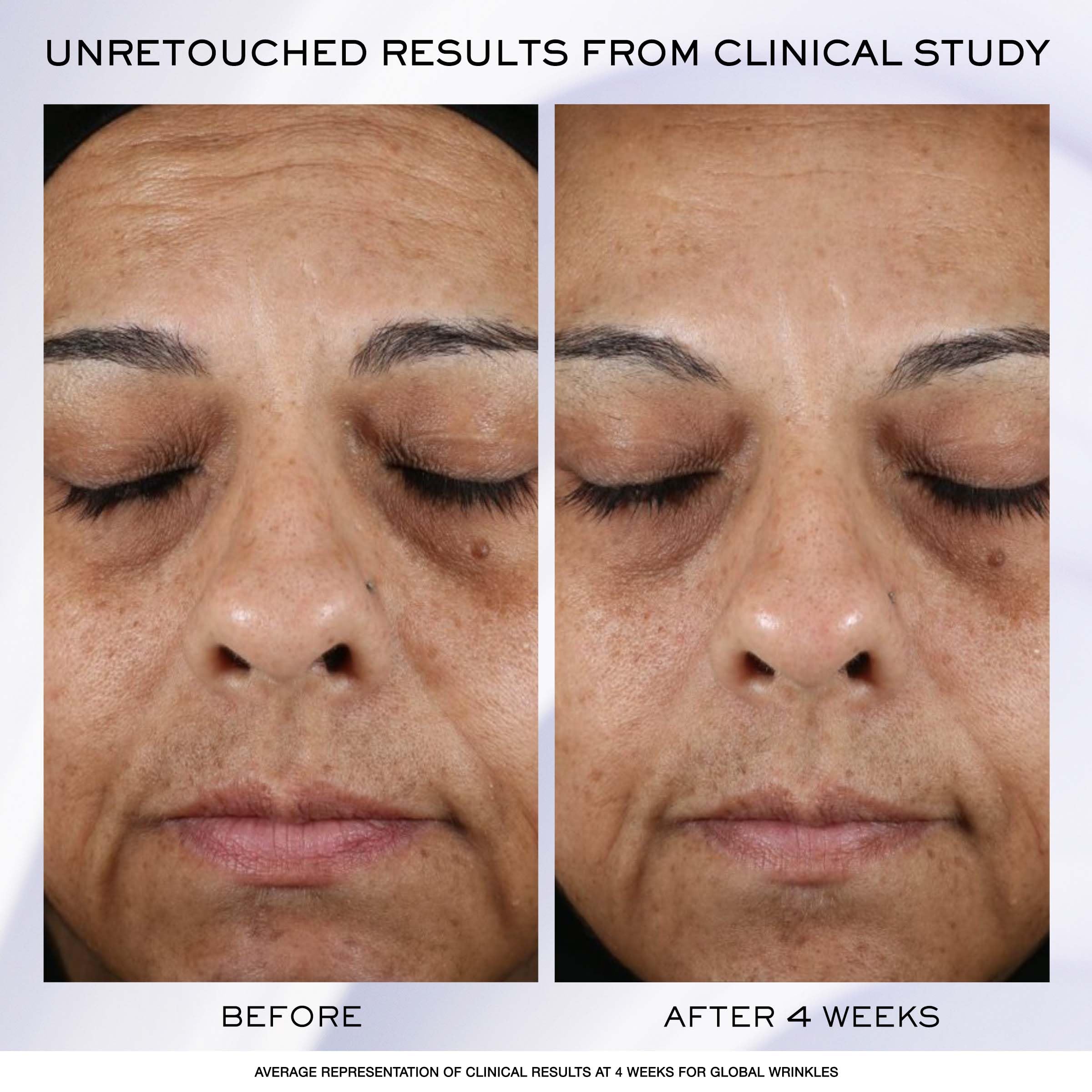 Lancôme Rénergie H.P.N. 300-Peptide Cream 50ml - Refill