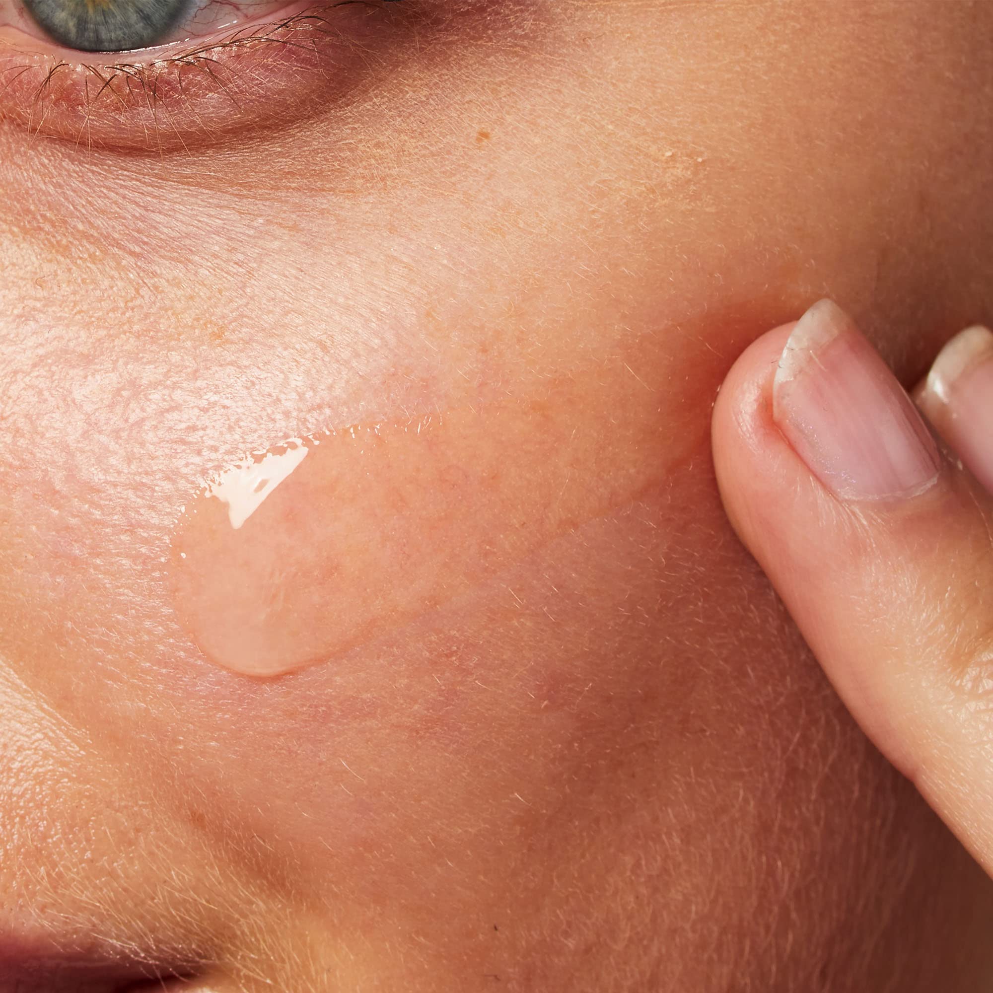 CeraVe Blemish Control Gel