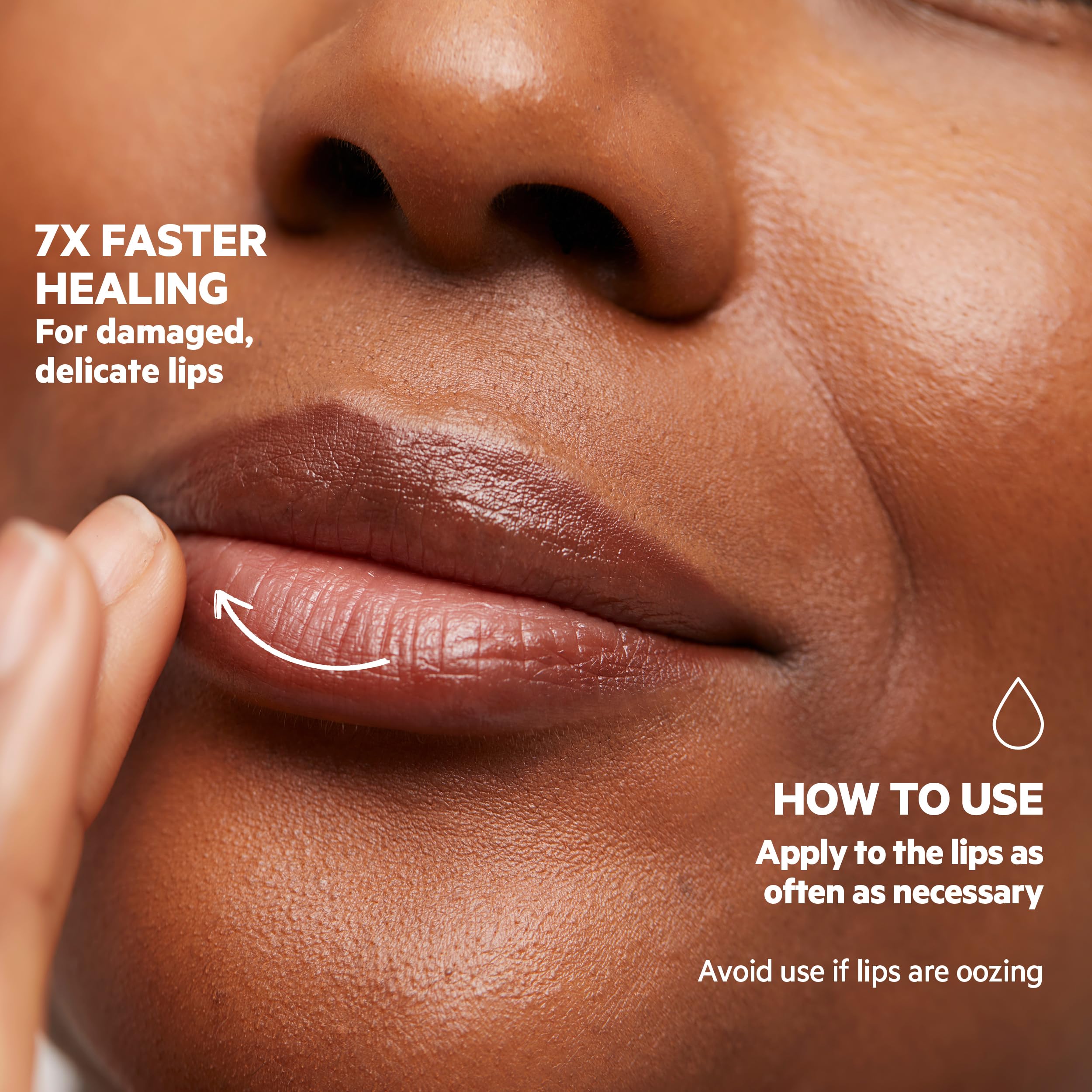 SVR Laboratoires Baume Levres Cicavit+ Protective Lip Balm 10g