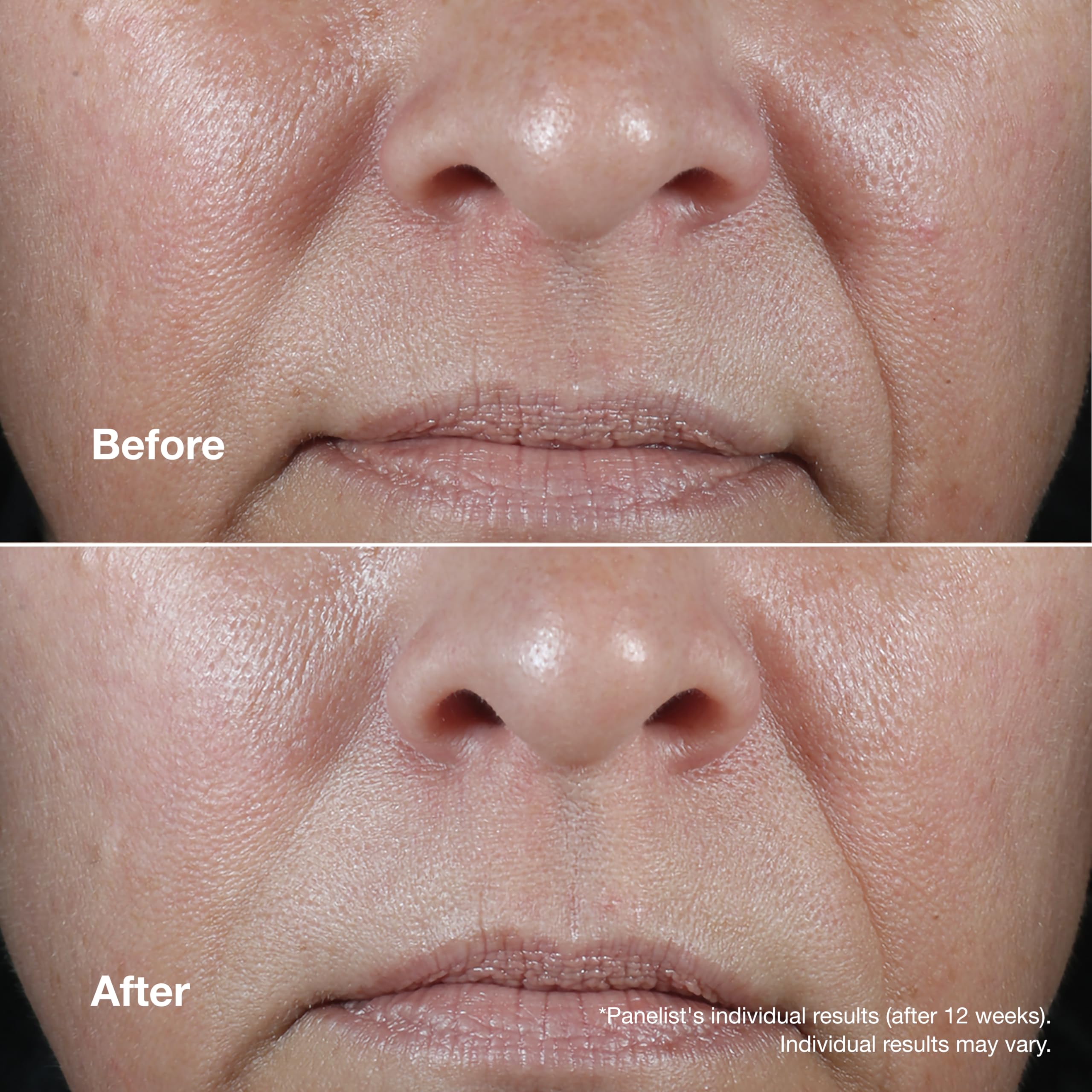 Clinique Smart Clinical Repair Wrinkle Correcting Rich Cream 50ml